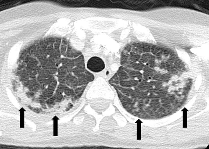 Figure 13a.