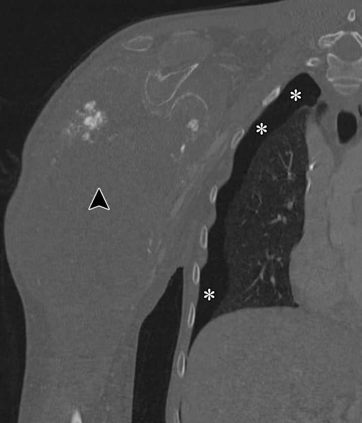 Figure 19b.