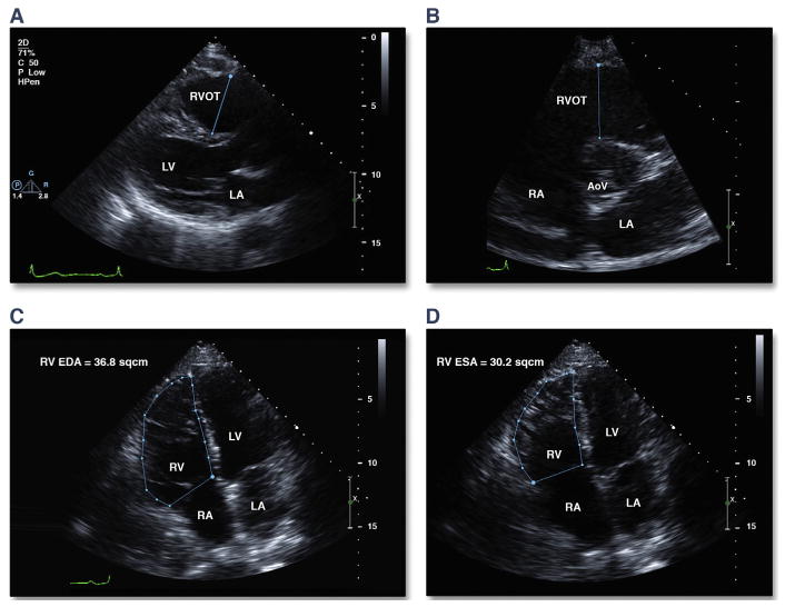 FIGURE 1