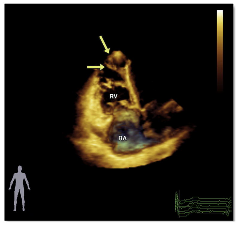 FIGURE 3