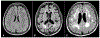 Fig. 30.4.