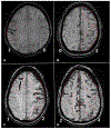 Fig. 30.3.