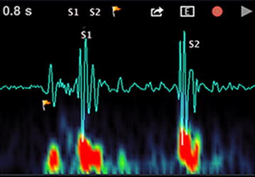 Figure 1