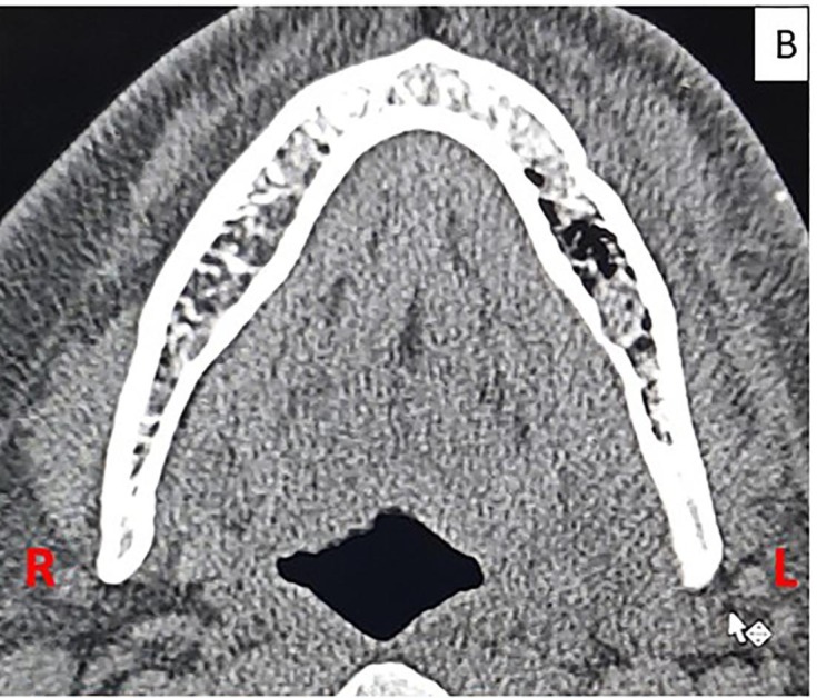 Fig. 1B