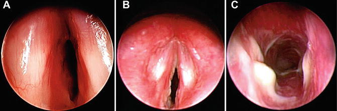 Fig. 12.2