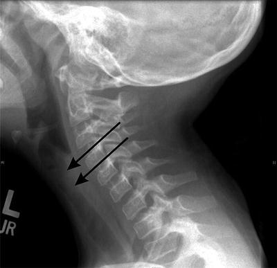 Fig. 12.3