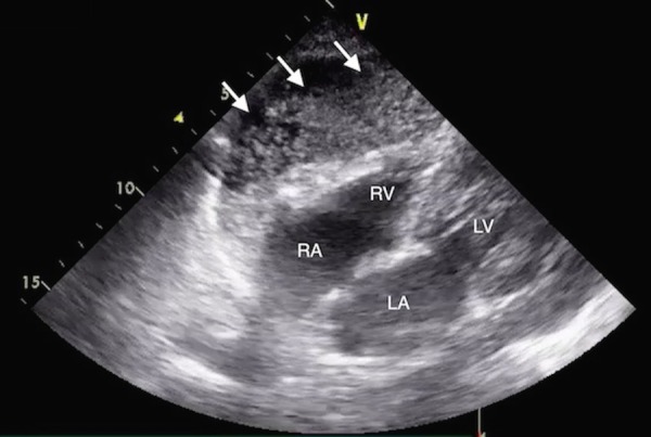 Figure 2