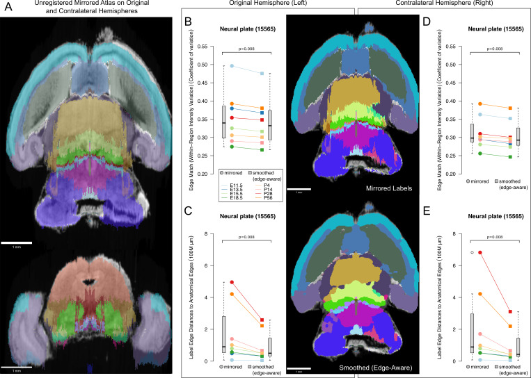 Figure 4—figure supplement 3.