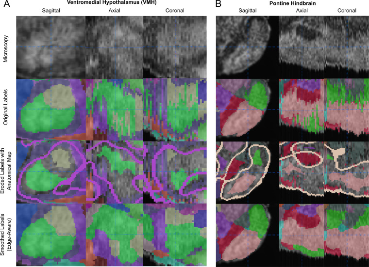 Figure 4—figure supplement 5.