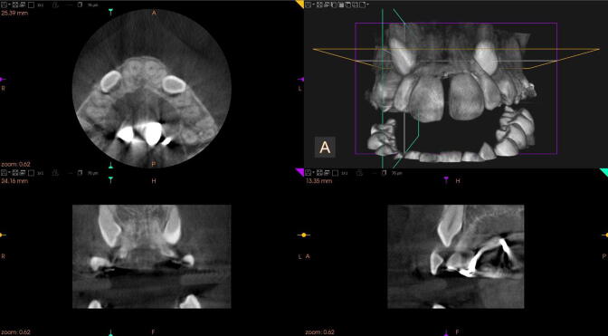 Fig. 2