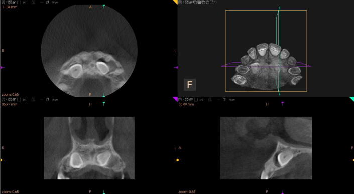 Fig. 3