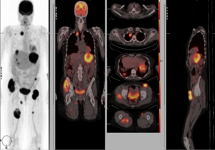 Fig. 1