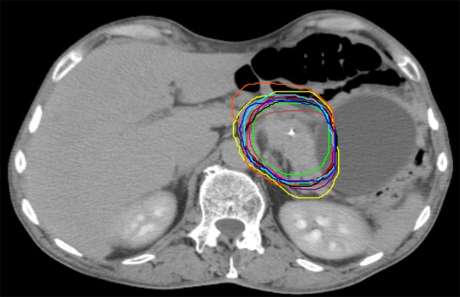 Fig. 2