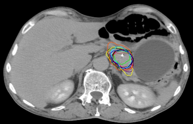 Fig. 1