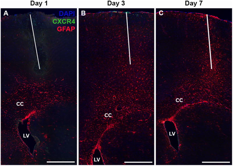 Figure 11