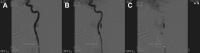 Fig 2
