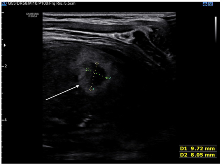 Figure 11