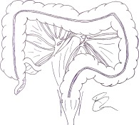 graphic file with name BJS5-2-433-g002.jpg