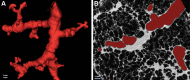 (A) Three-dimensional reconstruction of distal airway tree based on
specimen micro-CT scans shows typical tortuous and distorted airways. (B)
Cross-sectional micro-CT panel shows the absence of overt fibrosis in the
vicinity of the airway, which is highlighted in red.