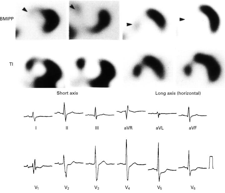 Figure 2  