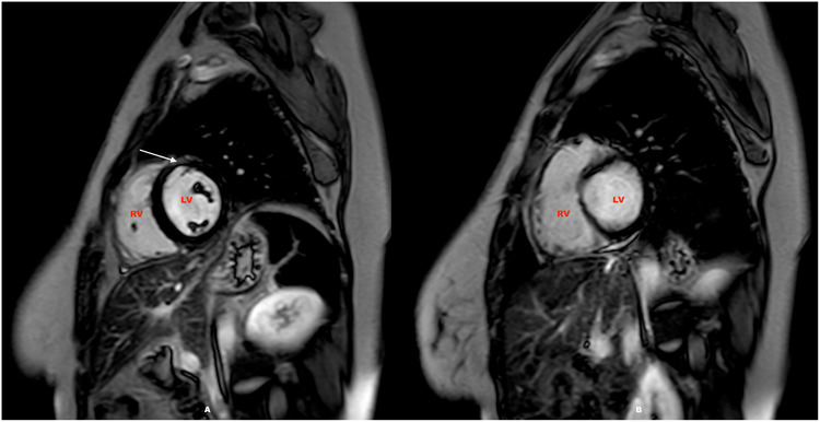 FIGURE 3