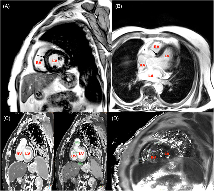 FIGURE 2