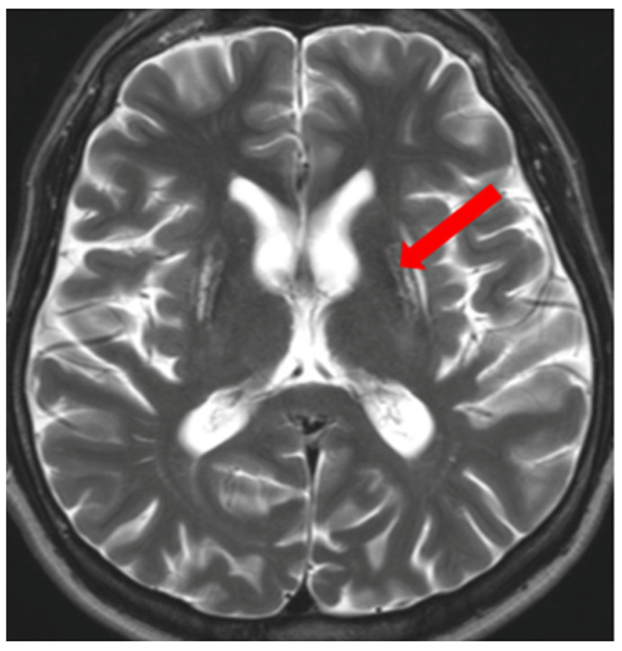 Figure 10