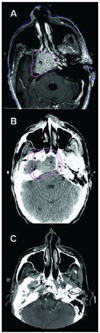 Fig: 3