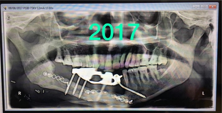 graphic file with name fx7.jpg