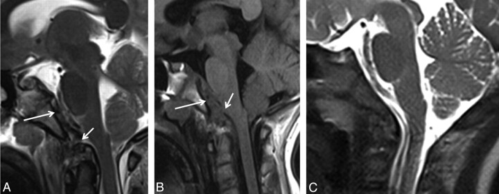 Fig 1.