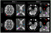 Figure 7:
