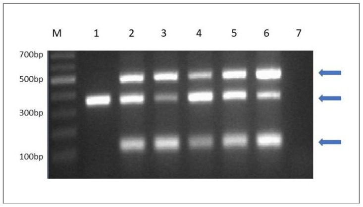 Figure 5