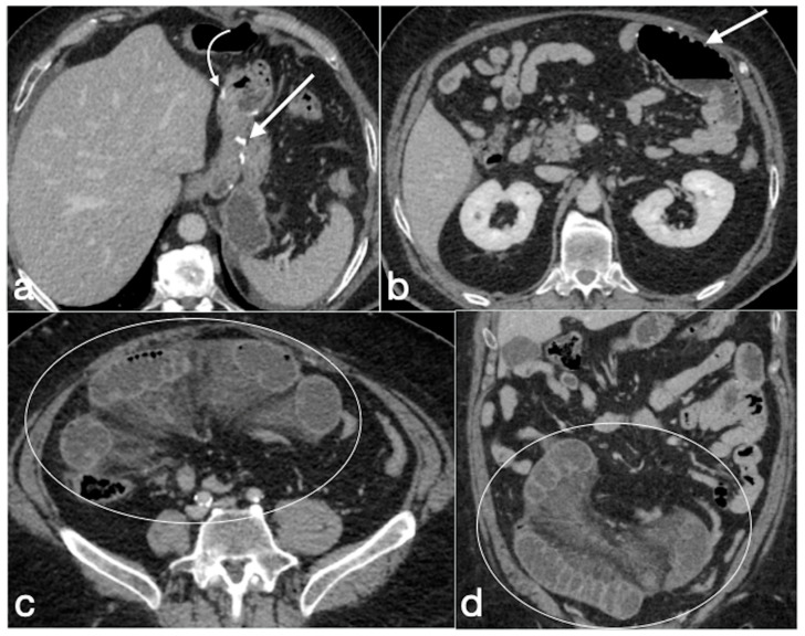 Figure 17