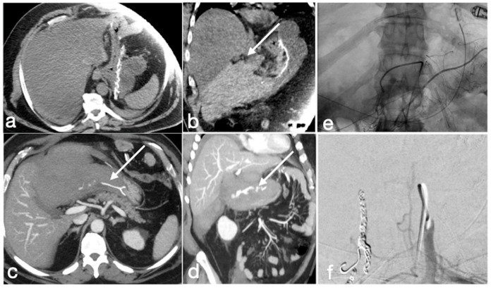 Figure 21