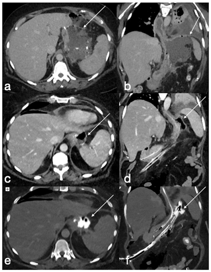 Figure 13