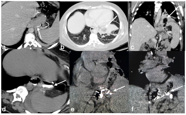 Figure 23