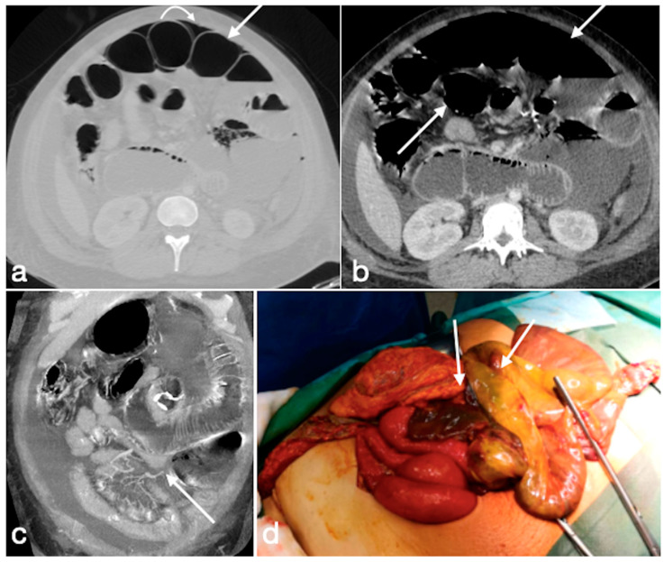 Figure 16