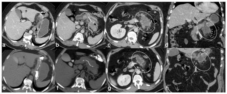 Figure 22