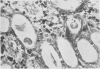 118-1
