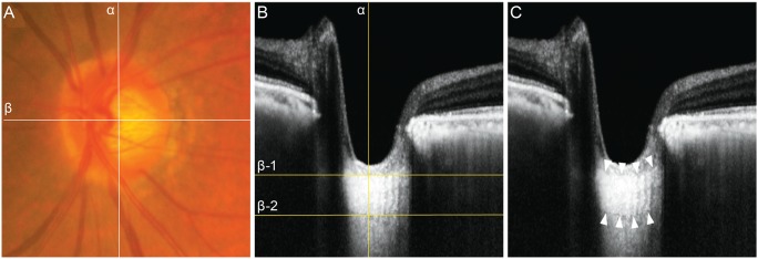 Fig. 1