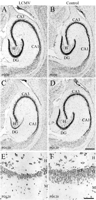 FIG. 11.