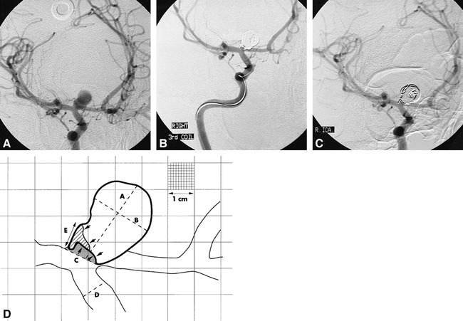 fig 2.