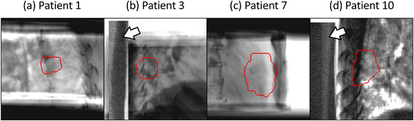 FIGURE 3