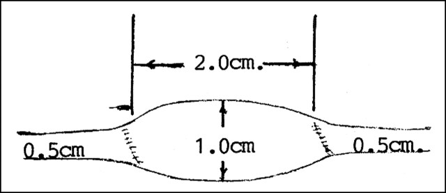 fig 1.