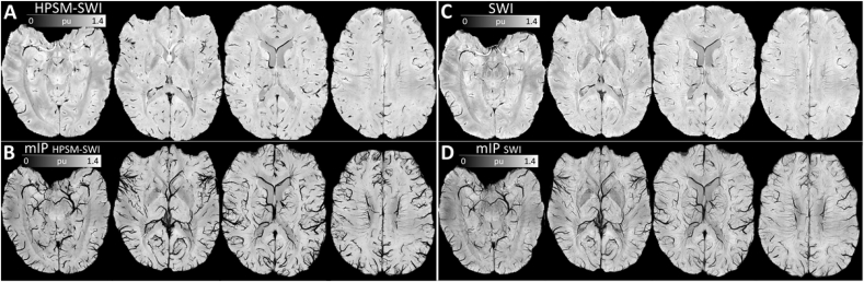 Fig. 10