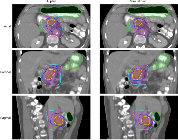 Figure 17