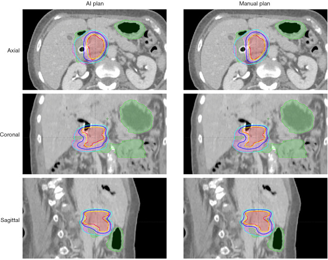 Figure 16