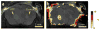 Fig. 12