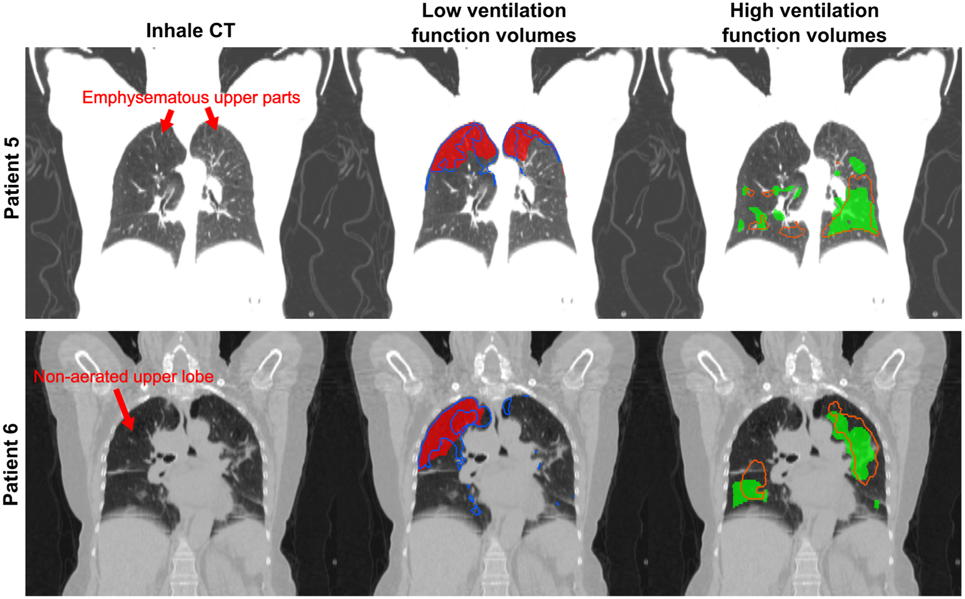 FIG. 5.