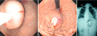 Fig. 1 a